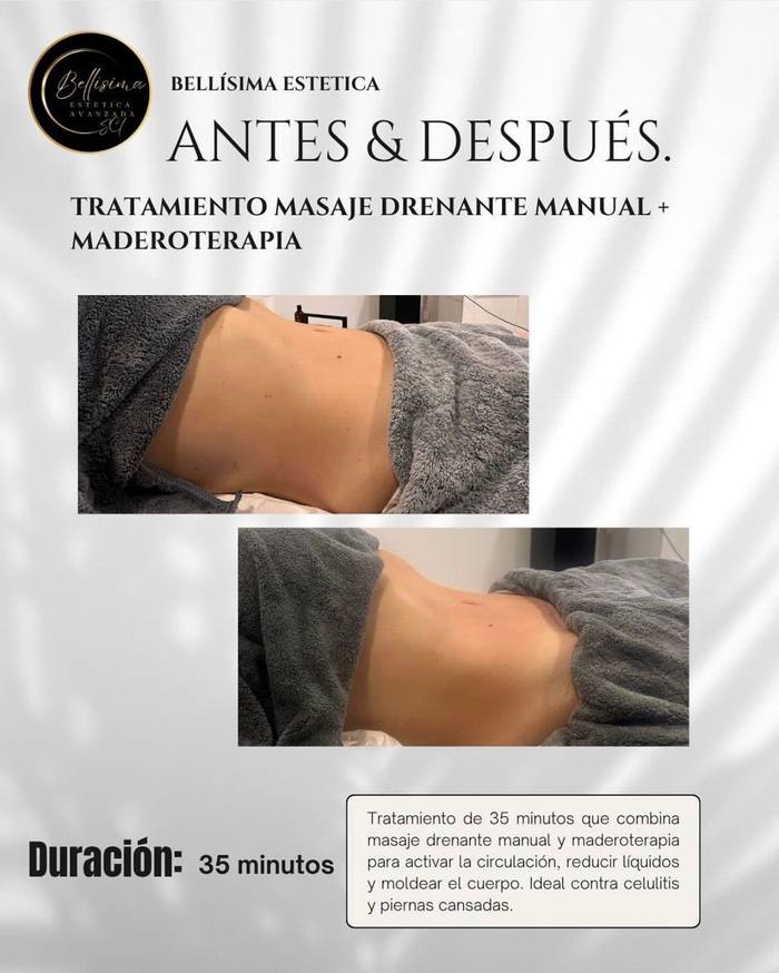 Antes y después drenaje abdominal