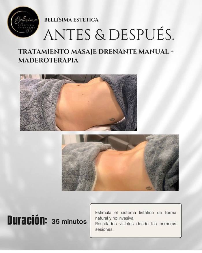 Antes y después drenaje linfático